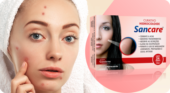 Como combater a acne com Curativos Hidrocolóide Sancare